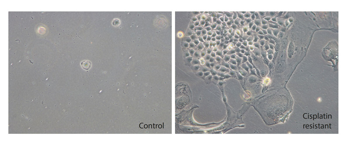 Während die Zellen links fast alle abgestorben sind, wachsen einzelne Zellen in der rechten, mit der Genschere behandelten Kultur auch unter Cisplatin und füllen schließlich fast die ganze die Petrischale.